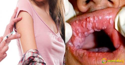 What Is HPV Infection And How It Can Affect Your Life