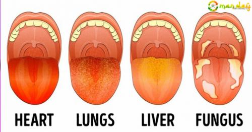 12 Health Problems You Can Identify Using Only Your Tongue