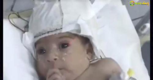 Child born with ’second head’, Ajman Ruler sponsors treatment