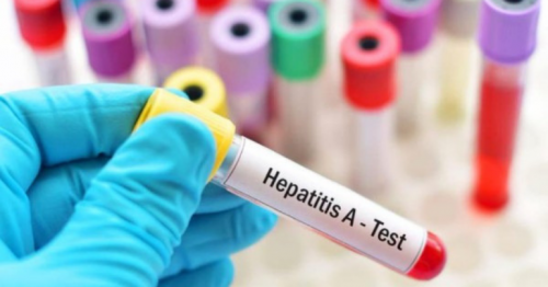 Oman, Latest Oman news, Oman health news, Hepatitis cases in Oman, latest hepatitis news in Oman, current Oman health news, Oman health