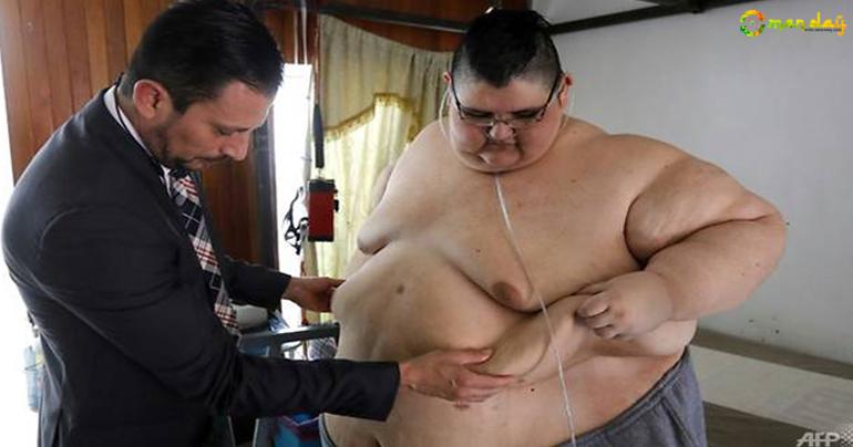 Mexican man, once the world’s fattest, dreams of walking again
