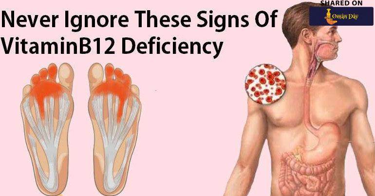 Never Ignore This Signs of Vitamin B12 Deficiency