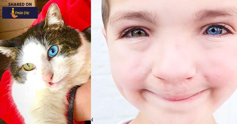 MadeForEachOther: Boy adopts Kitten with Heterochromia
