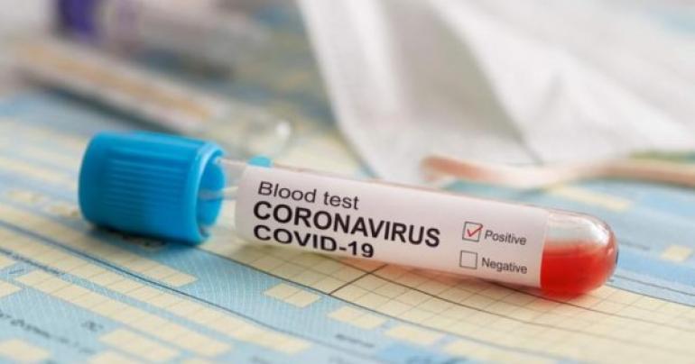 Oman registers 74 new coronavirus cases